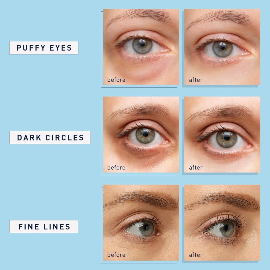 Enaskin Natural Under Eye Patches for Dark Circles

